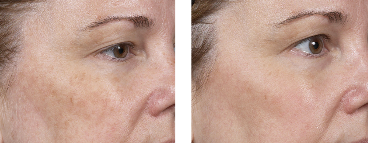 Skinspire Laser&Skin Clinic1