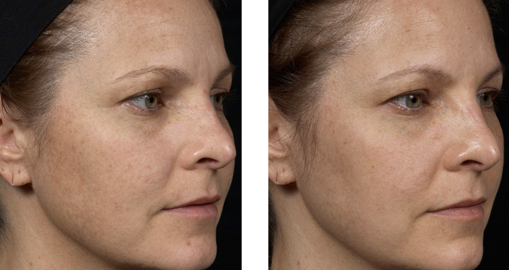 Skinspire Laser&Skin Clinic2